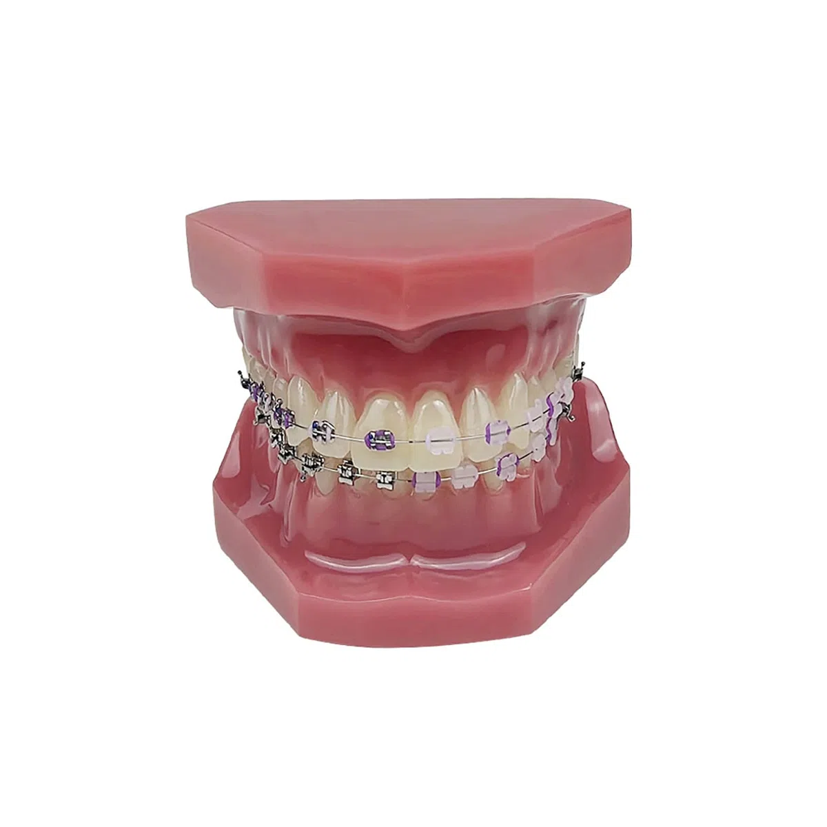 Modello ortodontico, YOUYA DENTAL 1/4 Confronto autobloccante in metallo Modello ortodontico Modello di dente ortodontico Modello di denti per l'insegnamento dentale Modello